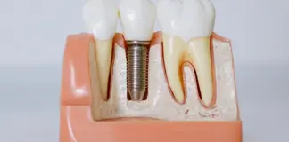 Alzira: muerte de una niña tras tratamiento dental image