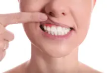 Diabetes en España: Más del 50% pierde dientes y el 66% sufre periodontitis