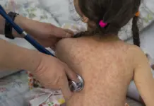 Alerta pediátrica: enfermedades resurgen ¿Qué está pasando?