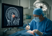 Nueva tecnología UMH detecta desplazamientos cerebrales en cirugías tumorales intracraneales