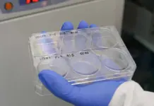 Tecnología ICP-MS: la clave para el diagnóstico precoz
