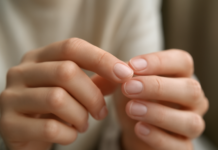 Descubre qué significan las manchas blancas en las uñas y cuándo preocuparte