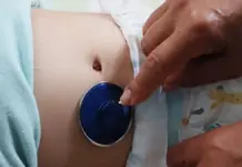 Prevención de enfermedades en Tlaxcala: ¡No te pierdas estos datos!