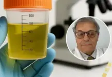 La sencilla prueba de orina que recomienda un nefrólogo