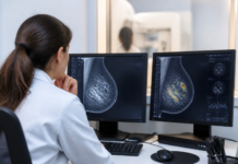 La IA en mamografías podría revelar riesgo cardiovascular