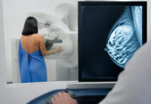 Mamografías para detectar problemas cardiovasculares ocultos