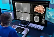 Philips, elegida por ARPA-H para aplicar IA y robótica al ictus