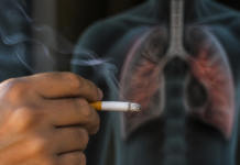 Tabaquismo: el gran riesgo para enfermedades respiratorias