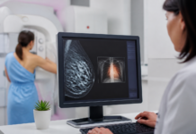 Osakidetza detecta riesgo cardiovascular en mamografías