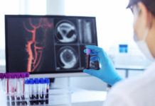 Medicina de precisión: la clave para anticipar la aterosclerosis