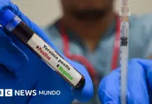 Peste neumónica: qué es y cómo se propaga tras una muerte