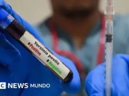 Peste neumónica: qué es y cómo se propaga tras una muerte