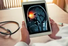 Meningitis en España: la enfermedad que alerta a neurólogos