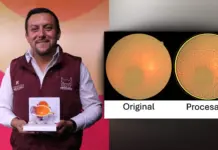 La UPT crea tecnología barata para mejorar imágenes de retina