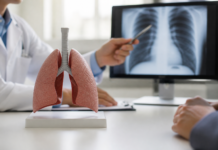 Adenocarcinoma pulmonar: el tumor extirpado a León XIV