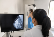 Bogotá alerta por la baja detección del cáncer de mama en 2025