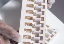 Virus Shamonda causa la primera muerte humana en Francia image